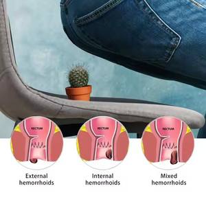 Salep Herbal Alami Cina untuk Wasir, Campuran untuk Penggunaan Luar dan Dalam, Krim untuk Nyeri Fisura Ani dan Wasir, 25g - Product Image 5