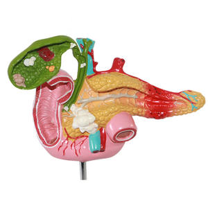 Sciedu Medical Anatomical Training Fígado Pâncreas Duodeno Modelo Patológico de modelos anatômicos da vesícula biliar - Product Image 3