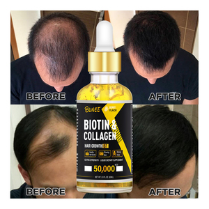 Biotina de colágeno para crecimiento del cabello, suero de aceite tónico para el crecimiento del cabello, 60ml, OEM - Product Image 2