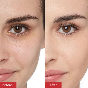 Crema Facial de Ácido Kójico Orgánico, Antienvejecimiento, Antiarrugas, Hidratante, Blanqueadora, para el Cuidado de la Piel - Product Image 5