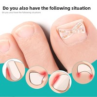 Correcteur d'ongles incarnés, attelle de correction pour ongles incarnés, clip de redressement d'ongles, patch de récupération