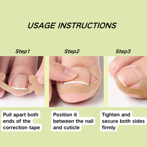 Parches Correctores de Uñas Encarnadas de Algodón Elástico Hipoalergénico Color Piel Sin Pegamento, Herramientas de Pedicura, Caja, Directo de Fábrica - Product Image 5