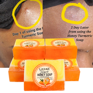 Lkiae özel glikolik asit yağı kontrol anti-kırışıklık hafifletmek çil parlayan güzellik cilt beyazlatma bal zerdeçal sabun - Product Image 2