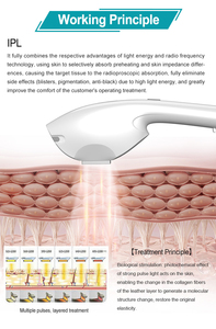 Dispositivo de Belleza 3 en 1 de 808nm: Solución Profesional para el Cuidado de la Piel, Depilación y Problemas de Pigmentación - Product Image 5