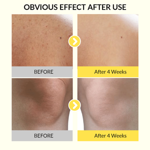 Gel <span class=keywords><strong>douche</strong></span> Santino à l'acide kojique, marque privée OEM ODM, pour un éclat sain et des soins quotidiens du corps - Product Image 4