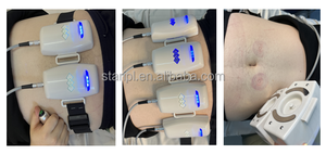 Beijing Starlight PEface estiramiento de la piel mini reducción de arrugas tratamiento de masaje magnético eléctrico máquina de belleza de estiramiento facial - Product Image 5