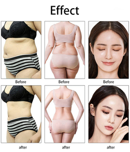 เครื่องนวดลดน้ำหนักและกระชับสัดส่วนแบบแรงดันลบระดับมืออาชีพ พร้อมฟังก์ชั่นผ่อนคลายกล้ามเนื้อ - Product Image 5