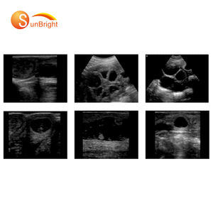 Harga mesin <span class=keywords><strong>Ultrasound</strong></span> dokter hewan USG genggam terbaik Tiongkok - Product Image 5