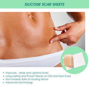 Elaimei Gel réparateur et cicatrisant, Patch en silicone auto-adhésif <span class=keywords><strong>pour</strong></span> cicatrices, vergetures, brûlures, accouchement par césarienne, Soin de beauté - Product Image 5