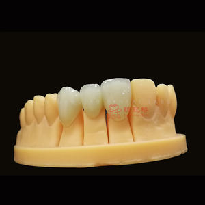 Laboratorio dentale eccellente precisione protesi fisse utilizzando materiale ceramico Zirconia porcellane tutte le corone e ponte in ceramica - Product Image 5