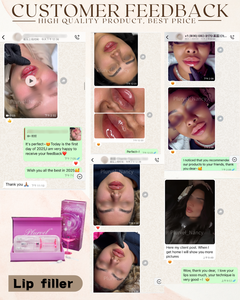 Rhinoplastie non chirurgicale professionnelle, lifting du pont nasal, <span class=keywords><strong>injection</strong></span> de gel d'acide hyaluronique, qualité supérieure - Product Image 6