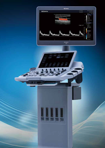 एडन एक्सालेट्रिक्स एलएक्स 3 वेट डायग्नोस्टिक अल्ट्रासाउंड सिस्टम ट्रॉली आधारित रंग डॉपलर पशु चिकित्सा इमेजिंग मशीन क्लिनिक अस्पताल - Product Image 3