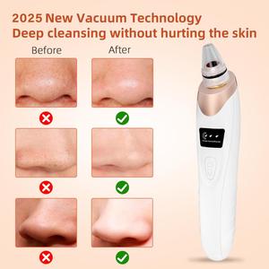 เครื่องดูดสิวเสี้ยนแบบพกพา ดูดซับสิ่งสกปรกบนผิวหน้า สำหรับดูแลผิวหน้า - Product Image 3