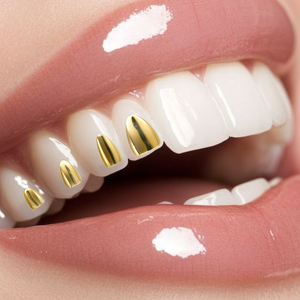 Grillz in Oro Vero 14k 18k Modello Lotus per Denti Piccoli con Gemme e Colla per Gioielli - Product Image 5