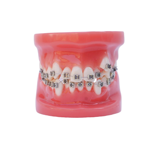 Modelo de Práctica de <span class=keywords><strong>Implantes</strong></span> <span class=keywords><strong>Dentales</strong></span> para Prótesis Totales, Modelo de Enseñanza de Prótesis Orales, Modelo Anatómico de <span class=keywords><strong>Implantes</strong></span> <span class=keywords><strong>Dentales</strong></span> - Product Image 5