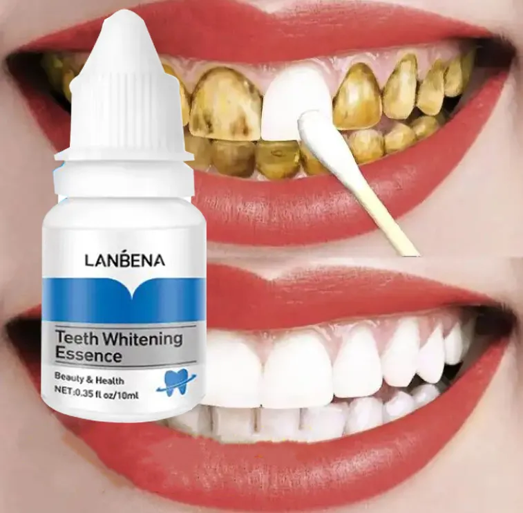 Professionele Gemakkelijke Witte Tanden Whitening Essence Liquid Groothandel Organische Mondverzorgingsoplossing Tanden Whiteners Met Wattenstaafje