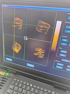 Pemindai <span class=keywords><strong>Ultrasound</strong></span> hewan peliharaan Digital penuh termurah harga mesin <span class=keywords><strong>Ultrasound</strong></span> portabel hewan peliharaan genggam - Product Image 6