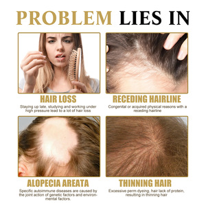 Esencia Capilar Roll-on <span class=keywords><strong>West</strong></span>&Month de 20 ml con Logotipo Personalizado, Reduce la Caída del Cabello, Fortalece y Oscurece, Suero de Masaje - Product Image 3