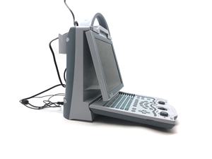 จีนอัลตราซาวนด์จักษุ AB ecobiometry เครื่องสแกนเนอร์จักษุวิทยา AB <span class=keywords><strong>Scan</strong></span> - Product Image 6