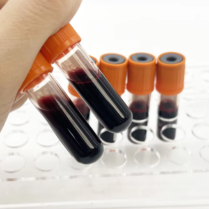 Longtime New Hematology <strong>Blood</strong> Control Low, <strong>Normal</strong>, High <strong>Levels</strong> - Product Image 5