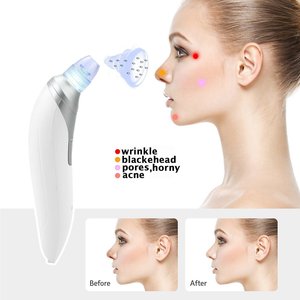 equipo de belleza recargable portátil de succión fuerte eliminar herramienta de puntos negros adsorción de vacío al acné herrami - Product Image 2
