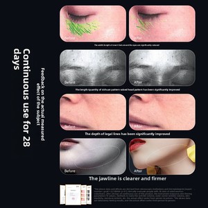 جهاز شد الوجه 6 في 1 محمول باليد للاستخدام المنزلي جهاز تدليك لتجديد شباب الوجه EMS منظف البشرة الفاتح ABS من المصنع الجديد الأكثر مبيعًا - Product Image 5