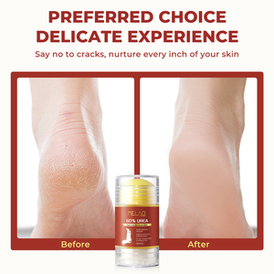 Crema Stick per la Cura della <span class=keywords><strong>Pelle</strong></span> dei Piedi con Etichetta Privata, Esfoliante Delicato, Ripristina Talloni Secchi e Screpolati, Rimuove la <span class=keywords><strong>Pelle</strong></span> Morta, Idratante con 60% di Urea - Product Image 6