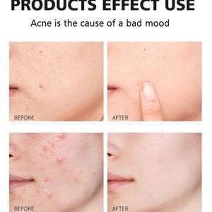 48 Parches Hidrocoloides para el Cuidado Facial, Perfeccionadores, Anti-Acné, Reparadores, Parches Invisibles para el Acné, Uso Diurno y Nocturno - Product Image 6