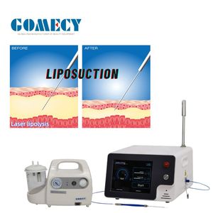 Nueva Tecnología Láser Endoláser de 980nm+1470nm 635nm para Tratamiento de Venas Varicosas y Arañas Vasculares, Fabricante Original - Product Image 1