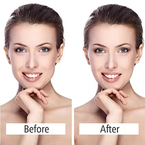 OEM Wholesale Collagen V-Shape <strong>Mask</strong> Double Chin Reducer V-Line Lift Neck Firming Patch <strong>Slimming</strong> Tightening Skin Whitening All - Product Image 4