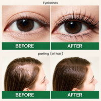 Minyak Penumbuh Rambut Rosemary Black Castor Mempromosikan Pertumbuhan Memperkuat Akar untuk Rambut Menipis OEM ODM Label Pribadi