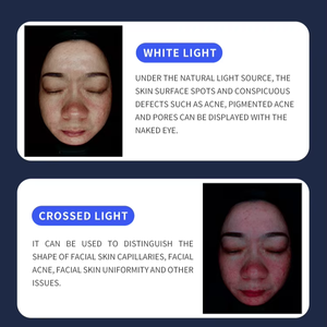 Analyseur de peau X5 Pro Analyseur de peau facial IA Scanner de problèmes de peau à 8 spectres Imagerie HD Diagnostic Analyse professionnelle - Product Image 5