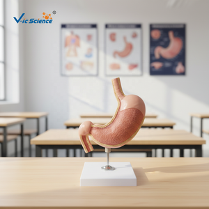 Modelli Anatomici per l'Insegnamento Medico: Modello di Stomaco con <span class=keywords><strong>Ulcere</strong></span>, Modello Anatomico del Sistema Digestivo - Product Image 5