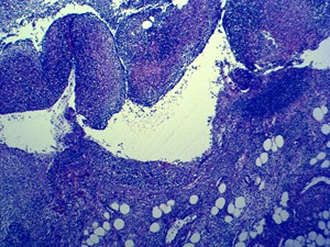 医学HenanYulinプロの人間の病理学スライド人間の炎症について - Product Image 2