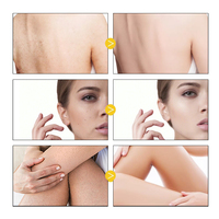 Nouvel arrivage en stock – Huile corporelle artisanale aux baies, aromathérapie, huile essentielle, hydratant pour une peau lisse et soyeuse, huile épicée – Vente en gros