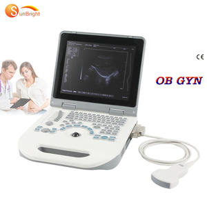 Sun밝은 초음파 에코 기계 병원 의료 초음파 기기 12.1 인치 디지털 초음파 - Product Image 1