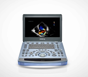 Appareil d'échographie vétérinaire portable Mindray Vetus M11 avec la meilleure qualité - Product Image 5