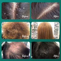 Savon Solide Capillaire Usma Grass Cypress – Traitement Populaire Anti-Pelliculaire et Revitalisant pour la Repousse des Cheveux