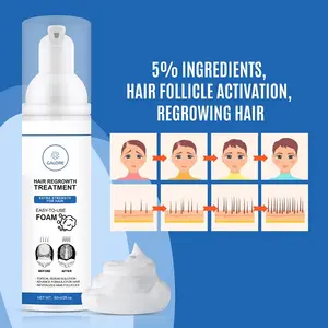3 Months Supply Biotin Collagen Mousse Hair Regrowth Treatments Hair Growth Spray Foam Serum