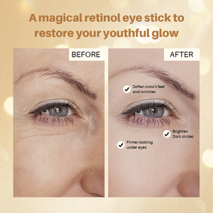 OEM Retinol Kafein Göz Çevresi Bakım Stick'i Sıkılaştırır, İnce Çizgileri Düzleştirir, Şişlikleri Azaltır, Nazik, Tahriş Etmeyen Göz Kremi Stick'i - Product Image 3