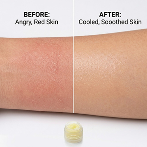Crème Visage Apaisante <span class=keywords><strong>Hydratante</strong></span> au <span class=keywords><strong>Sorbet</strong></span> de Thaïlande à l'Acide Hyaluronique et aux Baies de Thaïlande Végétaliennes Personnalisée – Soin Naturel Hydratant Après-Soleil - Product Image 3
