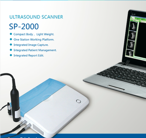 Échographe vétérinaire ophtalmique A/B SP-2000 – Équipement de diagnostic AB Scan pour ophtalmologie et biométrie oculaire - Product Image 4