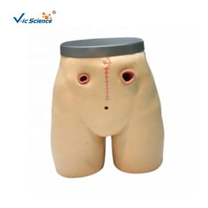 Điều Dưỡng trường cung cấp nâng cao fistulostomy chăm sóc mô hình y tế mô phỏng cho đào tạo điều dưỡng mô hình fistulostomy mô hình - Product Image 1