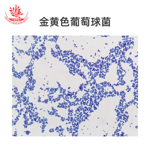 Staphylococcus aureus, un bactérien à Gram positif, est représenté par une coloration bleue au cristal violet. Étampe microbienne bactérienne. - Product Image 5