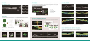 OSE-2800AS nhãn khoa quang học kết hợp chụp Cắt Lớp (Oct) Máy trước sau phân khúc hình ảnh cho các dụng cụ quang học mắt - Product Image 2