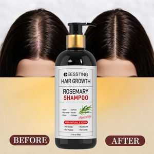 Champú Natural de Marca Propia con Biotina Orgánica, Anticaspa, para el Crecimiento del Cabello, Relajante, con Romero y Menta, Sin Sulfatos - Product Image 2