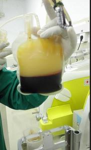 Medical Consumables at Low Prices and Excellent Quality Disposable Plastic <strong>Blood</strong> <strong>Bags</strong>