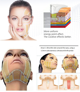 Máquina <span class=keywords><strong>HIFU</strong></span> Portátil 9D 3D, <span class=keywords><strong>HIFU</strong></span> Facial Antienvejecimiento y Antiarrugas, Máquina Adelgazante Corporal, <span class=keywords><strong>Precio</strong></span> de Fábrica en Venta - Product Image 3