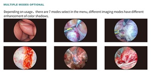 Harga Murah Sistem Kamera Endoskopi CMOS Full HD Medis untuk Laparoskopik Nasal Kaku ENT - Product Image 2