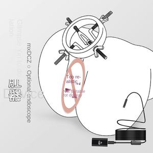 Эндоскоп Sm реквизит для секса, расширитель для киски, интимные части, Анальная пробка для полового акта, сокровище, муж и жена, совместная кровать, любовные инструменты - Product Image 4